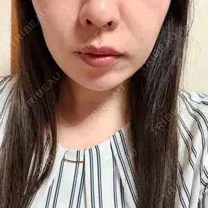 HAAB CLINIC HAAB×DREAM BEAUTY CLINIC 東京本院口コミ