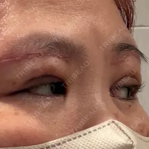湘南美容クリニック 湘南美容クリニック 千葉センシティ院口コミ