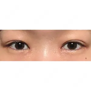 口コミ