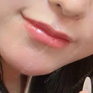 口コミ