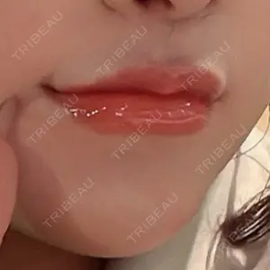 口コミ