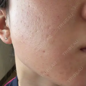 ルラ美容クリニック ルラ美容クリニック 新潟院口コミ