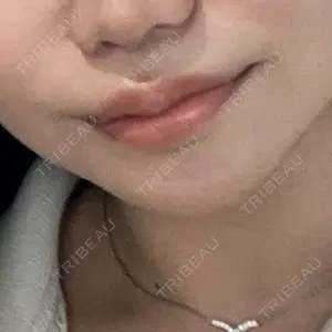 L‘amour clinic Tokyo【ラムールクリニック東京】口コミ