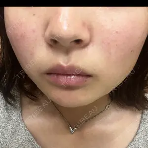 口コミ