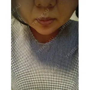 口コミ