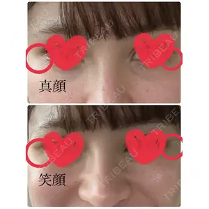 TCB東京中央美容外科 TCB東京中央美容外科 高崎院口コミ