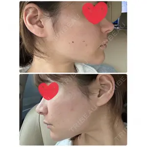 TCB東京中央美容外科 TCB東京中央美容外科 高崎院口コミ