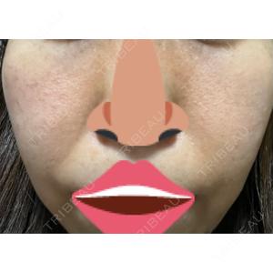 LIFIX BEAUTY CLINIC口コミ