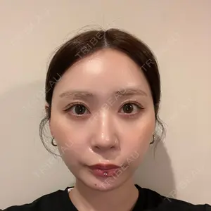 口コミ