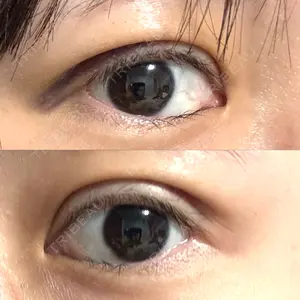藤・ナチュレ美容クリニック 藤・ナチュレ美容クリニック 銀座院口コミ