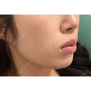 Nクリニック伏見口コミ