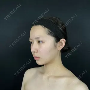 藤・ナチュレ美容クリニック 藤・ナチュレ美容クリニック 銀座院口コミ