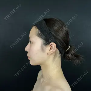 藤・ナチュレ美容クリニック 藤・ナチュレ美容クリニック 銀座院口コミ