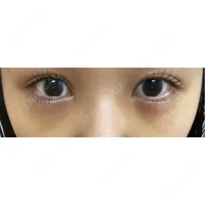 APOLLO BEAUTY CLINIC口コミ