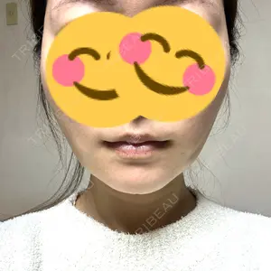 口コミ
