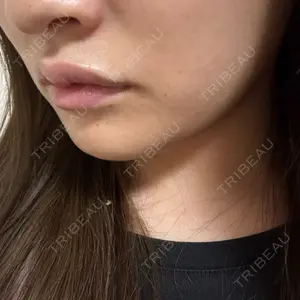 TCB東京中央美容外科 TCB東京中央美容外科 岡山院口コミ