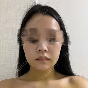 HAAB CLINIC HAAB×DREAM BEAUTY CLINIC 東京本院口コミ