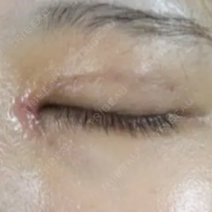 藤・ナチュレ美容クリニック 藤・ナチュレ美容クリニック 銀座院口コミ