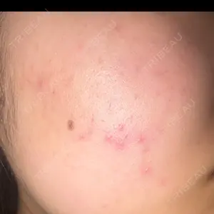 ルラ美容クリニック ルラ美容クリニック 広島院口コミ