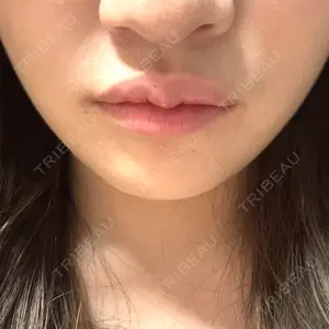 TCB東京中央美容外科 TCB東京中央美容外科 岡山院口コミ