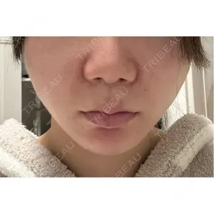 新宿ラクル美容外科クリニック 新宿ラクル美容外科クリニック 新宿院口コミ