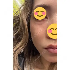 プロクリニック PRO CLINIC プロクリニック 銀座院口コミ