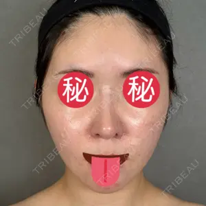 口コミ