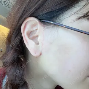 口コミ