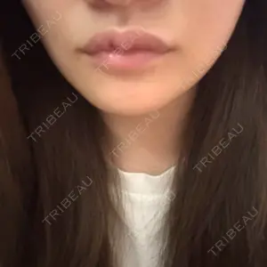 TCB東京中央美容外科 TCB東京中央美容外科 岡山院口コミ