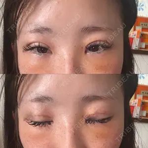口コミ