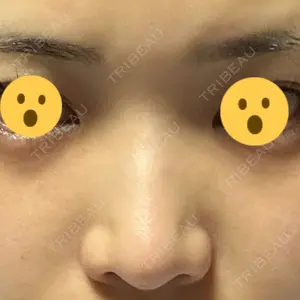 口コミ
