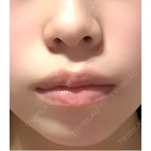 ルラ美容クリニック ルラ美容クリニック 宇都宮院口コミ