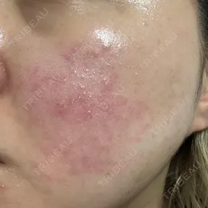 おおかみ美容のクリニック おおかみ美容のクリニック 新宿院口コミ
