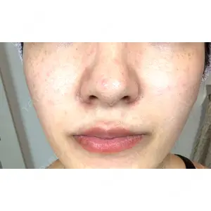 おおかみ美容のクリニック おおかみ美容のクリニック 新宿院口コミ