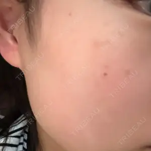 おおかみ美容のクリニック おおかみ美容のクリニック 新宿院口コミ