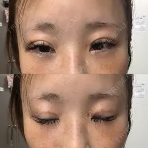 口コミ