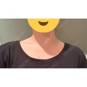 APスキンクリニック銀座口コミ