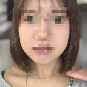 AYANAフィラーズクリニック AYANAフィラーズクリニック 渋谷院口コミ