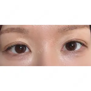 口コミ