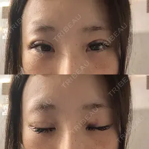口コミ