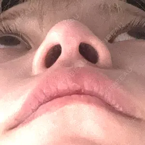 口コミ