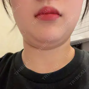口コミ
