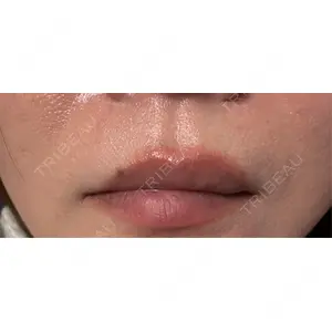 HAAB CLINIC HAAB×DREAM BEAUTY CLINIC 大阪梅田院口コミ