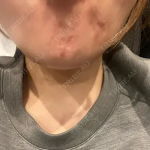 口コミ