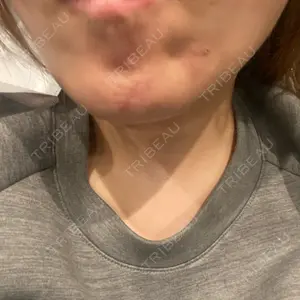 口コミ