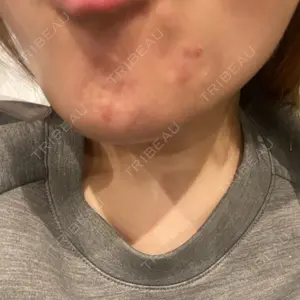 口コミ
