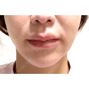 HAAB×DREAM BEAUTY CLINIC 大阪梅田院の