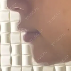 アネシス美容クリニック口コミ