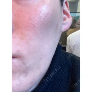 やさしい美容皮膚科・皮フ科 やさしい美容皮膚科・皮フ科　秋葉原院口コミ