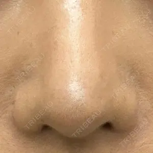 口コミ
